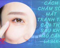 CÁCH CHĂM SÓC MẮT TRÁNH TÁI CẬN THỊ SAU KHI MỔ CẬN LASIK